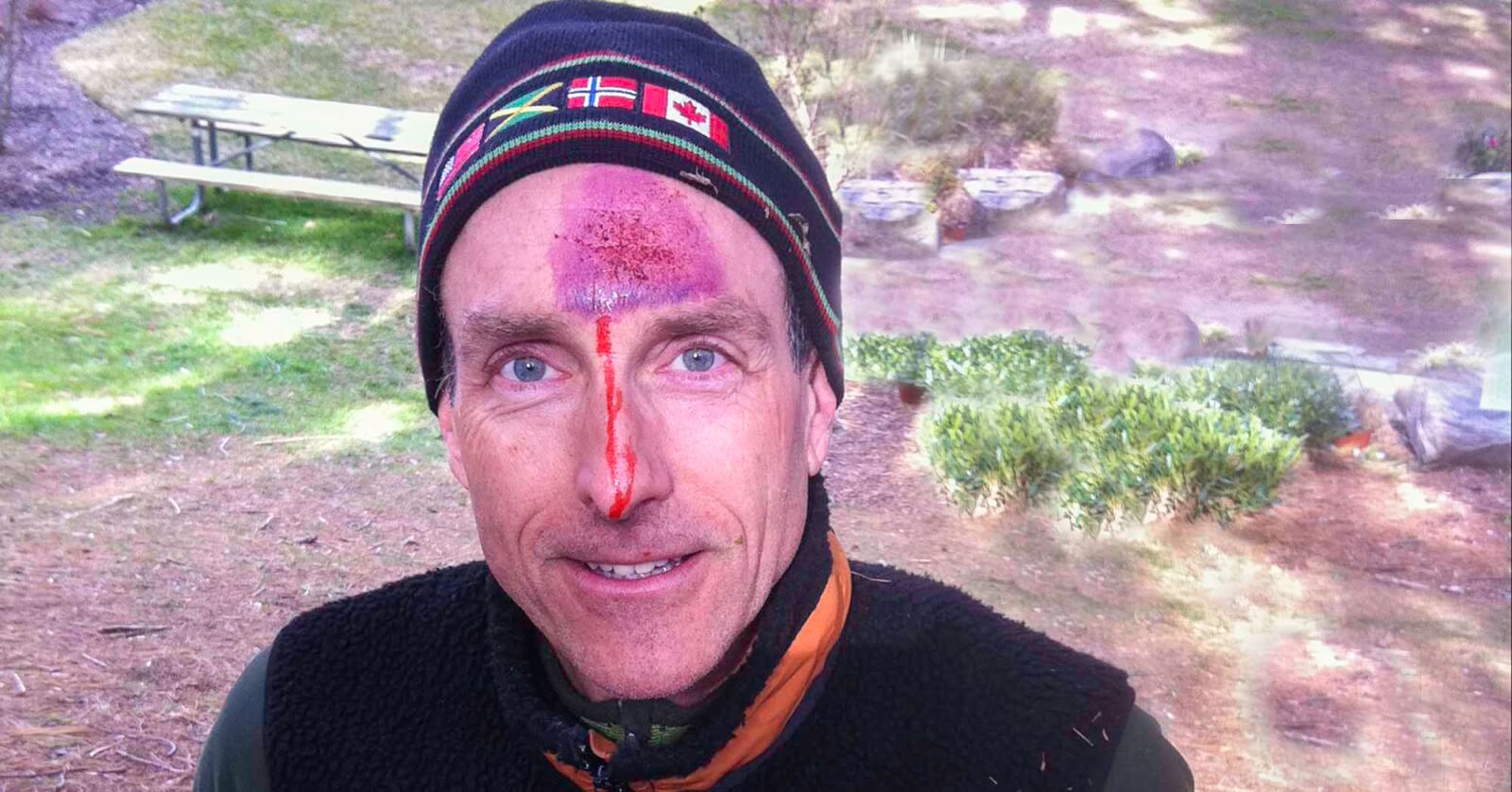 Why Wilderness First Aid Matters and How to Take a Course